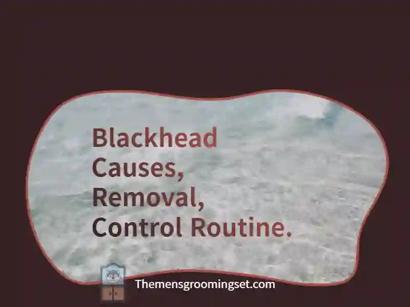 Blackhead causes, removal, 2 ways to control it