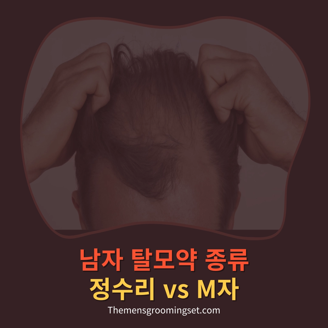 남자 탈모약 종류 대표 이미지