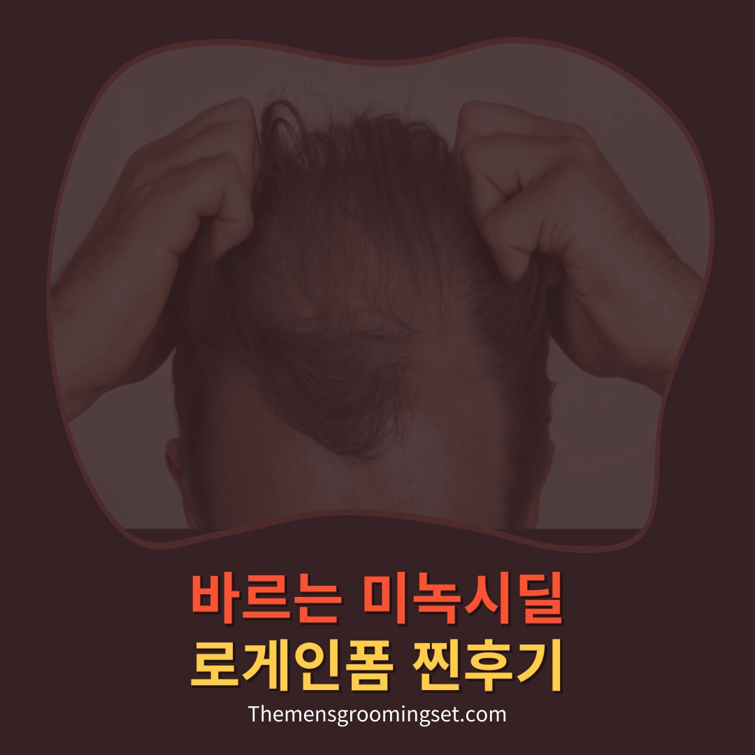 바르는 미녹시딜 로게인폼 후기 대표 이미지
