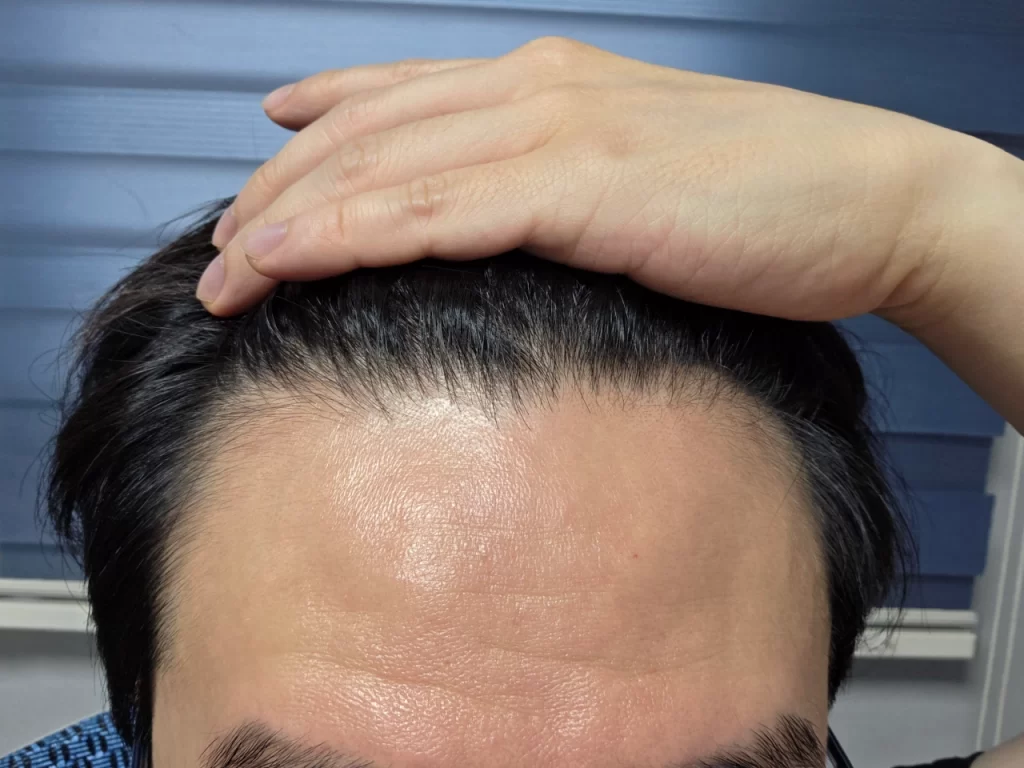 이마가 넓을 뿐